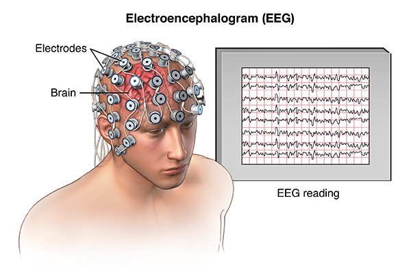 EEG Measures of Cognition
