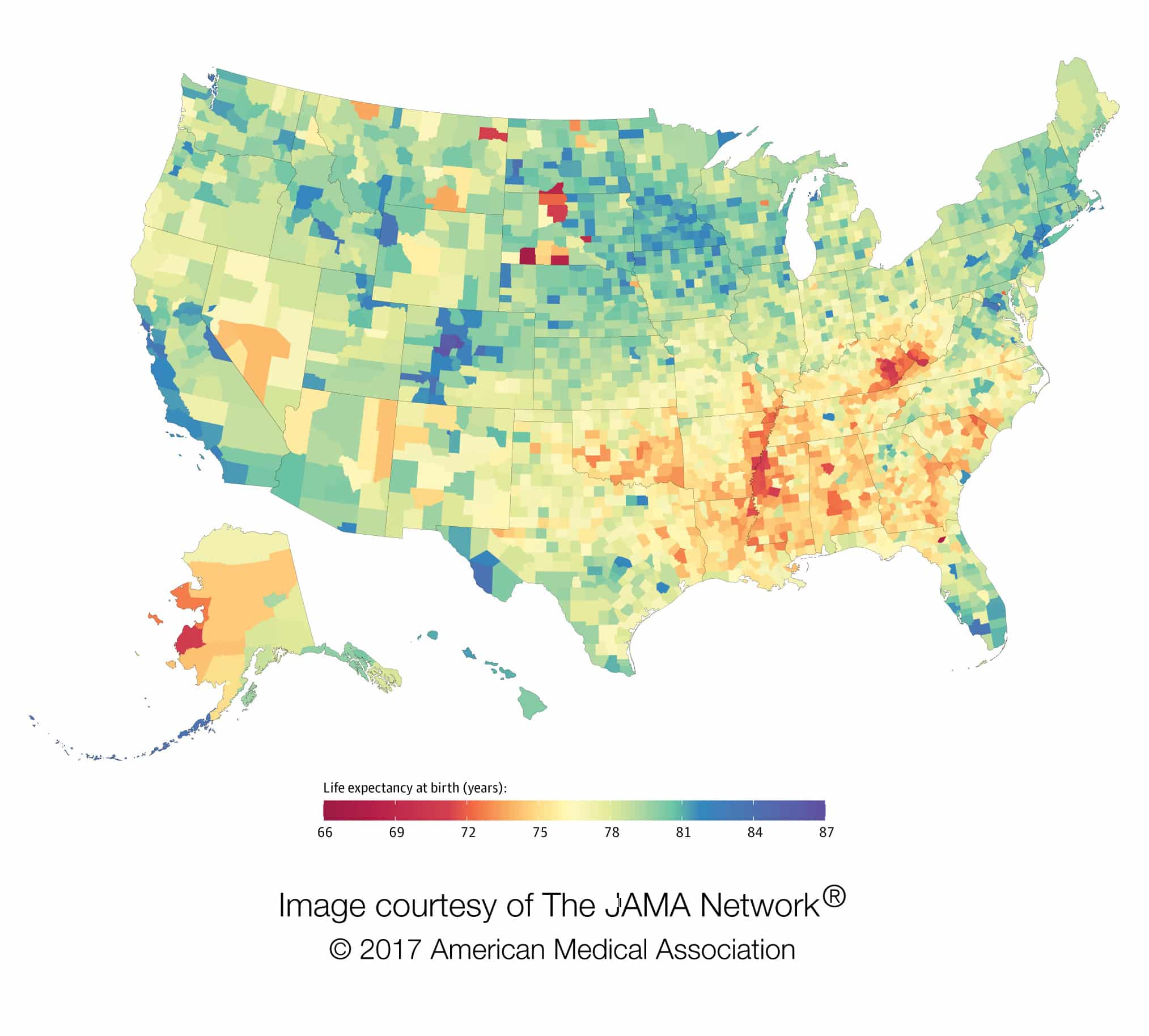 Geographic Disparities in Life Expectancy Among U.S. Counties