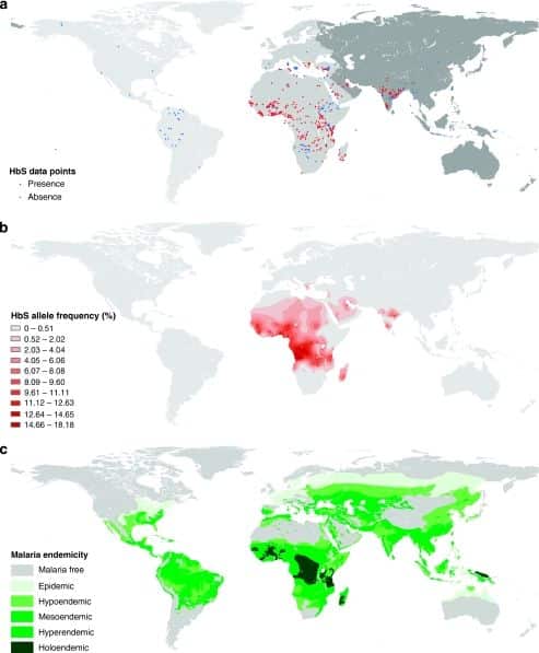 Global distribution of the sickle cell gene and geographical ...