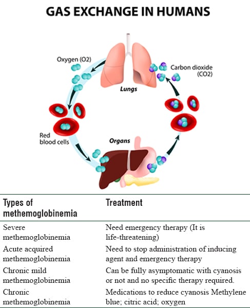 Methemoglobinemia