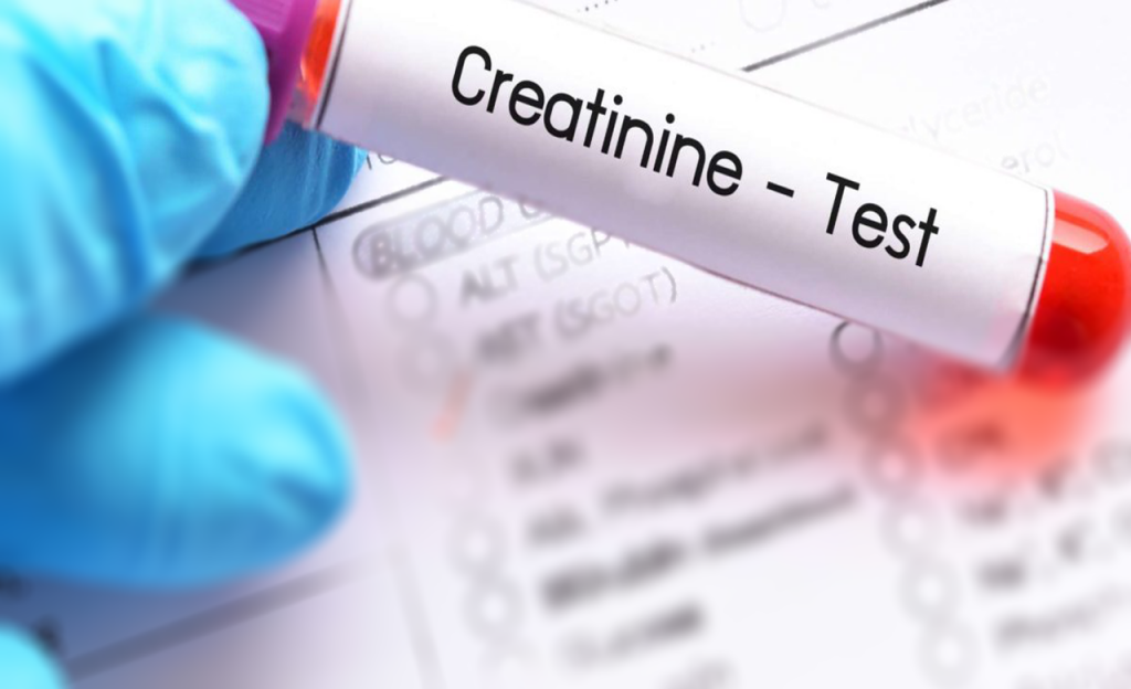 Serum Creatinine Test: About,Normal Range, How to lower ...